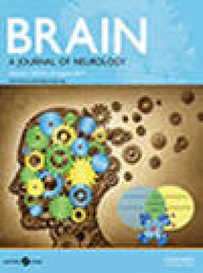 Brain雜志